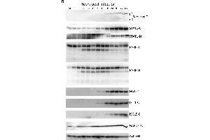 Western blot validation of host protein regulation. (ISG15 anticorps)