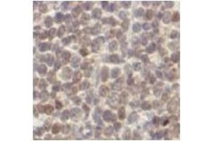 Immunohistochemistry (IHC) image for anti-Cyclin D1 (CCND1) antibody (ABIN1106871)