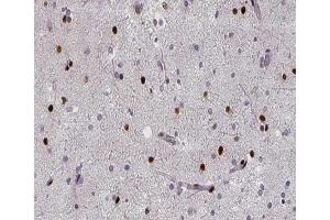 ABIN6267394 at 1/200 staining human brain tissue sections by IHC-P. (RPA2 anticorps  (pThr21))