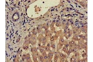 Immunohistochemistry of paraffin-embedded human liver tissue using ABIN7145926 at dilution of 1:100