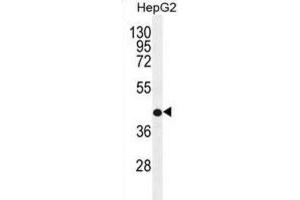 Western Blotting (WB) image for anti-Retinol Dehydrogenase 13 (All-Trans and 9-Cis) (RDH13) antibody (ABIN2996498) (RDH13 anticorps)