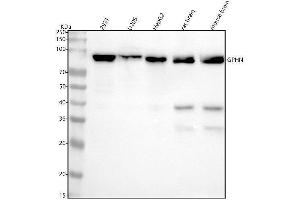 Western blot analysis of Gephyrin using anti-Gephyrin antibody (ABIN7604961).