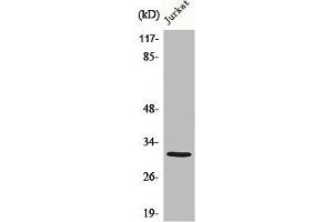 Western Blot analysis of various cells using C1QBP Polyclonal Antibody diluted at 1:1000 (C1QBP anticorps  (Internal Region))