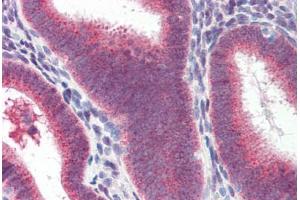 Human Uterus (formalin-fixed, paraffin-embedded) stained with Heat Shock Protein 70 (HSP70) antibody ABIN364327 at 10 ug/ml followed by biotinylated anti-mouse IgG secondary antibody ABIN481714, alkaline phosphatase-streptavidin and chromogen. (HSP70 anticorps  (AA 1-641))