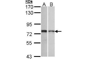 Western Blotting (WB) image for anti-Zinc Finger Protein 398 (ZNF398) (AA 358-630) antibody (ABIN467495) (ZNF398 anticorps  (AA 358-630))
