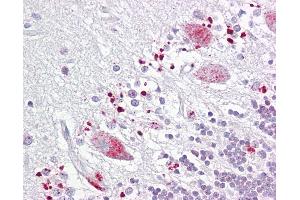 Anti-C12orf5 / TIGAR antibody IHC of human brain, cerebellum. (TIGAR anticorps  (AA 140-190))