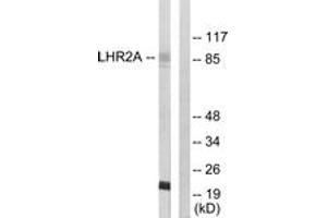 Western blot analysis of extracts from 293 cells, using LHR2A Antibody. (VWA5A anticorps  (AA 371-420))