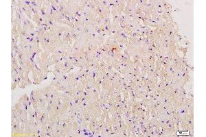 Formalin-fixed and paraffin embedded mouse myocardium labeled with Anti-Myoglobin Polyclonal Antibody, Unconjugated  at 1:200 followed by conjugation to the secondary antibody and DAB staining. (Myoglobin anticorps  (AA 21-120))