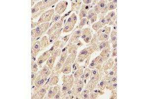 (ABIN391619 and ABIN2841538) staining ANXA2 in Human liver tissue sections by Immunohistochemistry (IHC-P - paraformaldehyde-fixed, paraffin-embedded sections). (Annexin A2 anticorps  (N-Term))