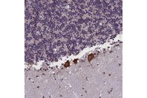 Immunohistochemical staining of human cerebellum with KCNE1L polyclonal antibody  shows strong cytoplasmic positivity in purkinje cells. (KCNE1-Like anticorps)
