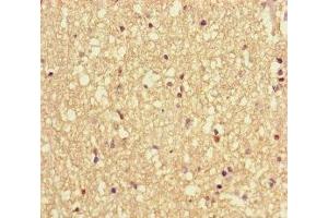 Immunohistochemistry of paraffin-embedded human brain tissue using ABIN7175471 at dilution of 1:100 (VAMP1 anticorps  (AA 1-96))