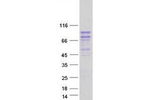 Validation with Western Blot