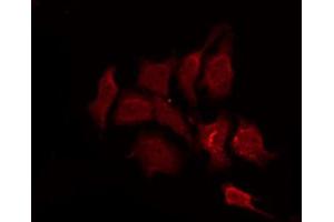 ABIN6267259 staining SK-OV3 by IF/ICC. (EGFR anticorps  (pThr693))