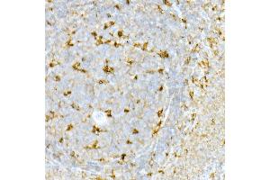 Immunohistochemistry of paraffin-embedded human colon using STING/TMEM173 Rabbit pAb (ABIN1683049, ABIN3017833, ABIN3017834 and ABIN6220283) at dilution of 1:50 (40x lens).