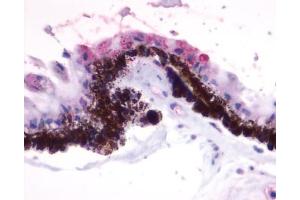 Anti-RGR antibody IHC of human eye, pigmented epithelium within the retina. (RGR anticorps  (Extracellular Domain))