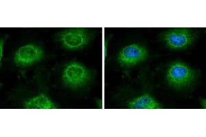 ICC/IF Image LARS2 antibody [N2C1], Internal detects LARS2 protein at mitochondria by immunofluorescent analysis. (LARS2 anticorps)