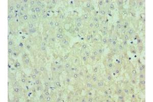 Immunohistochemistry of paraffin-embedded human liver tissue using ABIN7156797 at dilution of 1:100 (IL13RA2 anticorps  (AA 27-343))