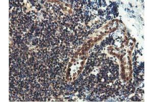 Image no. 9 for anti-Epsin 2 (EPN2) antibody (ABIN1498049)