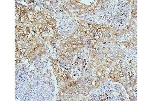 IHC analysis of EIF4G1 using anti-EIF4G1 antibody (ABIN7601860).