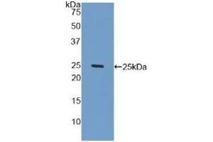 Detection of Recombinant GLb, Human using Polyclonal Antibody to Galactosidase Beta (GLb)