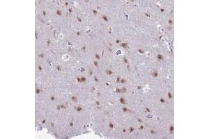 Immunohistochemical staining of human cerebral cortex with NOVA2 polyclonal antibody  shows moderate nuclear positivity in neuronal cells at 1:20-1:50 dilution. (NOVA2 anticorps)