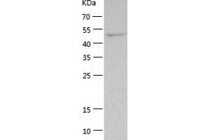 Western Blotting (WB) image for Thymidine Phosphorylase (TYMP) (AA 11-482) protein (His tag) (ABIN7125385)