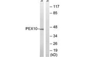 Western blot analysis of extracts from Jurkat cells, using PEX10 Antibody.