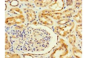 Immunohistochemistry of paraffin-embedded human kidney tissue using ABIN7144235 at dilution of 1:100 (ANKRD55 anticorps  (AA 151-326))