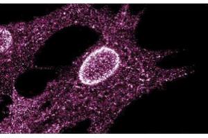 Immunofluorescent staining on Human Fibroblasts