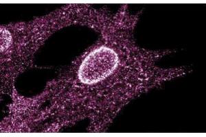 Immunofluorescent staining on Human Fibroblasts (LYN anticorps  (AA 1-138))