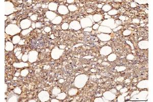 IHC analysis of Sorbitol Dehydrogenase/SORD using anti-Sorbitol Dehydrogenase/SORD antibody (ABIN7602485).