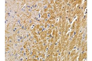 ABIN7094174 and ABIN7098219 at 1/100 staining rat brain tissue by IHC-P.
