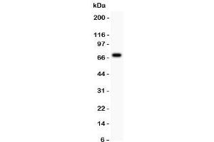 Western blot tesing of AFP antibody and HEPG2 lysate.