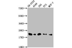 Western Blot Positive WB detected in: SH-SY5Y whole cell lysate, A549 whole cell lysate, 293 whole cell lysate, PC-3 whole cell lysate, MCF-7 whole cell lysate All lanes: ITGB1BP1 antibody at 1:2000 Secondary Goat polyclonal to rabbit IgG at 1/50000 dilution Predicted band size: 22, 17 kDa Observed band size: 22 kDa (ITGB1BP1 anticorps  (AA 1-200))