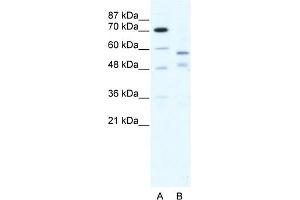 WB Suggested Anti-TRIM23 Antibody Titration:  5. (TRIM23 anticorps  (C-Term))