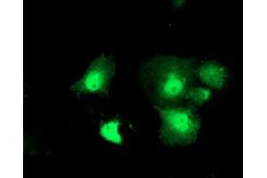 Immunofluorescence (IF) image for anti-Deoxythymidylate Kinase (Thymidylate Kinase) (DTYMK) antibody (ABIN1497918) (DTYMK anticorps)