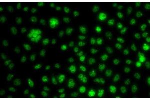 Immunofluorescence analysis of A549 cells using UBE2R2 Polyclonal Antibody (UBE2R2 anticorps)