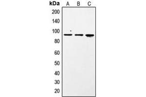 Western blot analysis of STAT1 (pS727) expression in A431 (A), NIH3T3 insulin-treated (B), Jurkat pervanadate-treated (C) whole cell lysates. (STAT1 anticorps  (C-Term, pSer727))