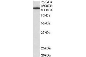 Staining of NIH3T3 lysate using Myosin-Ib antibody at 1 µg/ml (35µg protein in RIPA buffer). (Myosin IB anticorps  (Internal Region))