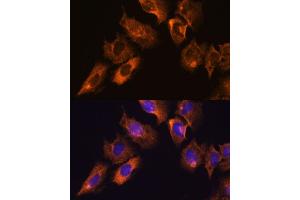 anti-CaM Kinase-Like Vesicle-Associated (CAMKV) (AA 1-285) antibody