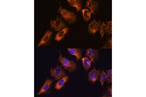 Immunofluorescence analysis of C6 cells using CAMKV antibody (ABIN7266051) at dilution of 1:100. (CAMKV anticorps  (AA 1-285))