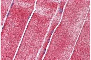 Human Skeletal Muscle: Formalin-Fixed, Paraffin-Embedded (FFPE)