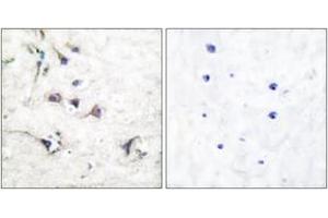 Immunohistochemistry analysis of paraffin-embedded human brain tissue, using Ezrin Antibody. (Ezrin anticorps  (AA 511-560))