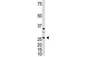 Image no. 1 for anti-Dickkopf Homolog 4 (Xenopus Laevis) (DKK4) (C-Term) antibody (ABIN357074) (DKK4 anticorps  (C-Term))