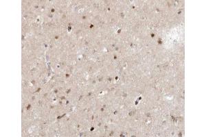 ABIN6266659 at 1/100 staining human brain tissue sections by IHC-P. (SENP7 anticorps  (C-Term))