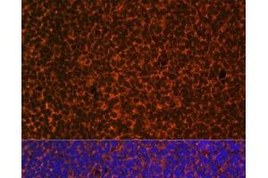 Immunofluorescence analysis of Mouse embryos cells using PTCH1 Polyclonal Antibody at dilution of 1:100.