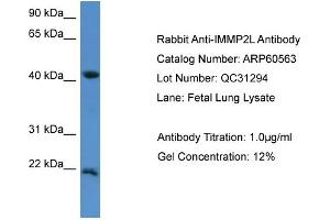 WB Suggested Anti-IMMP2L  Antibody Titration: 0.