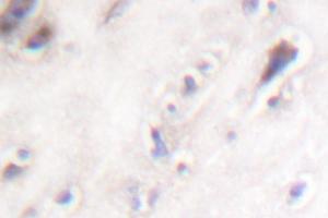 Image no. 2 for anti-Islet Amyloid Polypeptide (IAPP) antibody (ABIN271869) (Amylin/DAP anticorps)