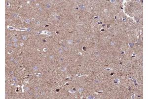ABIN6269408 at 1/100 staining human brain tissue sections by IHC-P. (CaMK2 alpha/delta anticorps)
