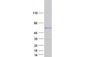 Validation with Western Blot
